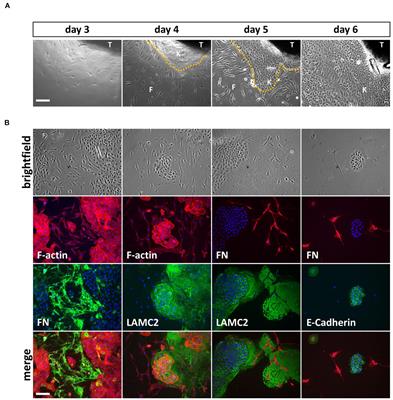 Keratinocytes Isolated From Individual Cleft Lip/Palate Patients Display Variations in Their Differentiation Potential in vitro